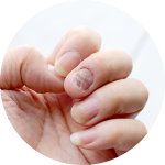 Chirurgie dermatologica