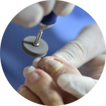 Chirurgie dermatologica